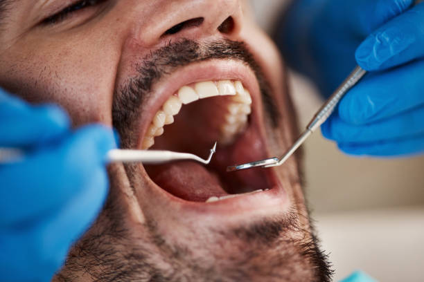 Best Weekend Emergency Dentist in Chapel Hill, NC
